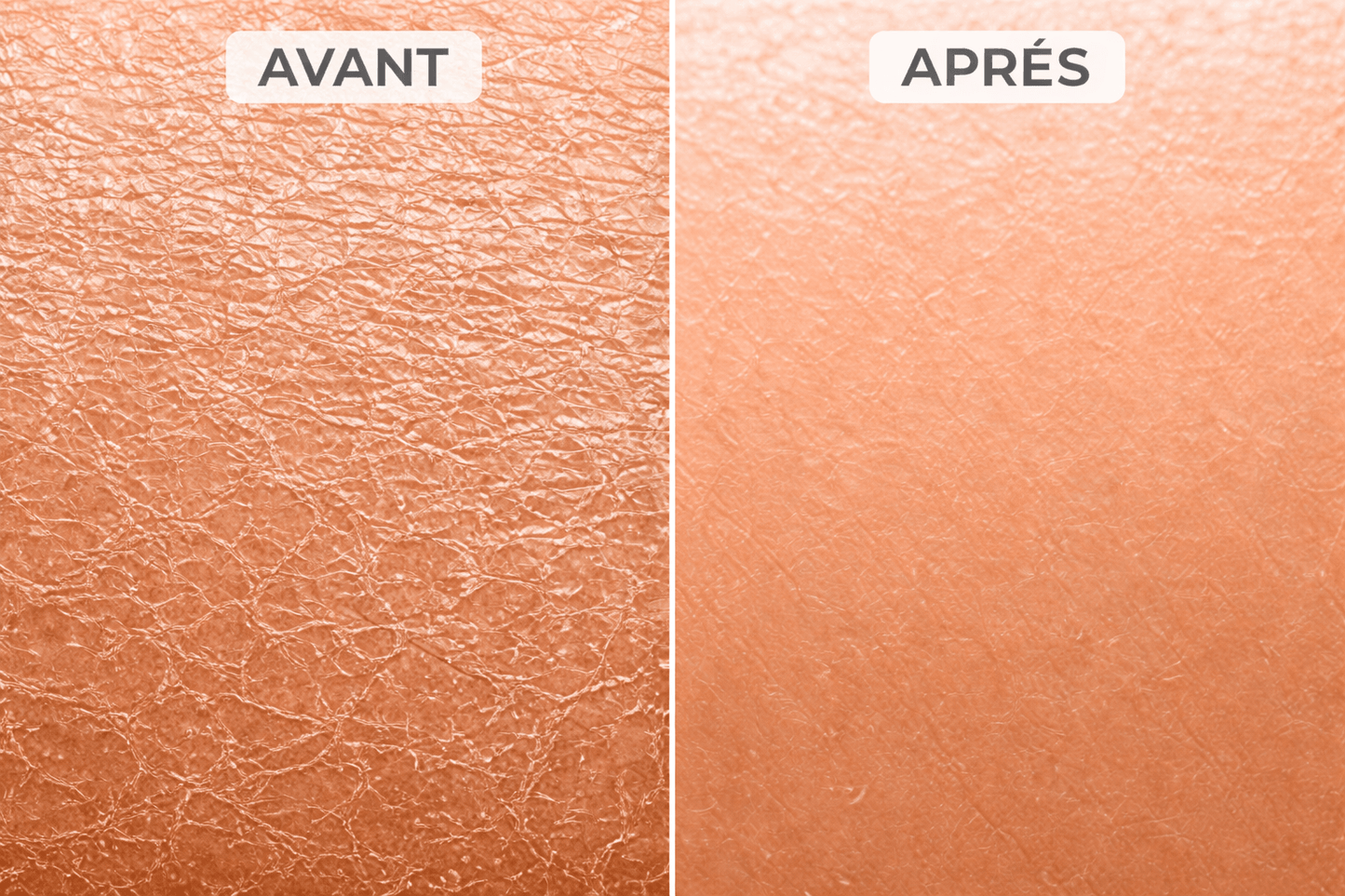 Gant exfoliant kératose pilaire - Louvaro™