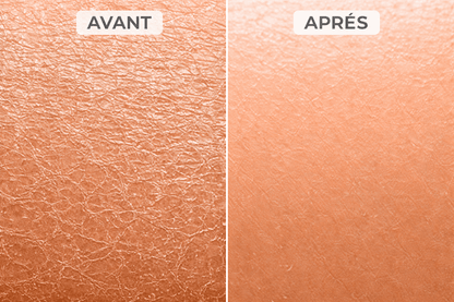 Gant exfoliant kératose pilaire - Louvaro™
