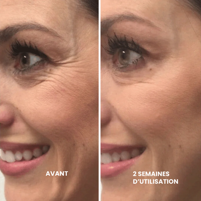 Retinal Shot - Le soin anti-âge