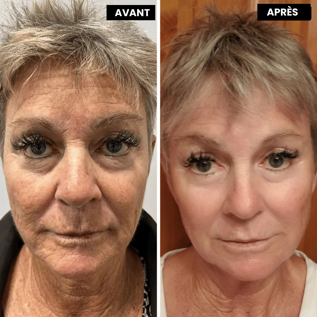 Retinal Shot - Le soin anti-âge