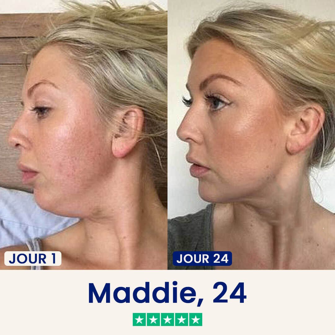 Masque lifting Double Menton