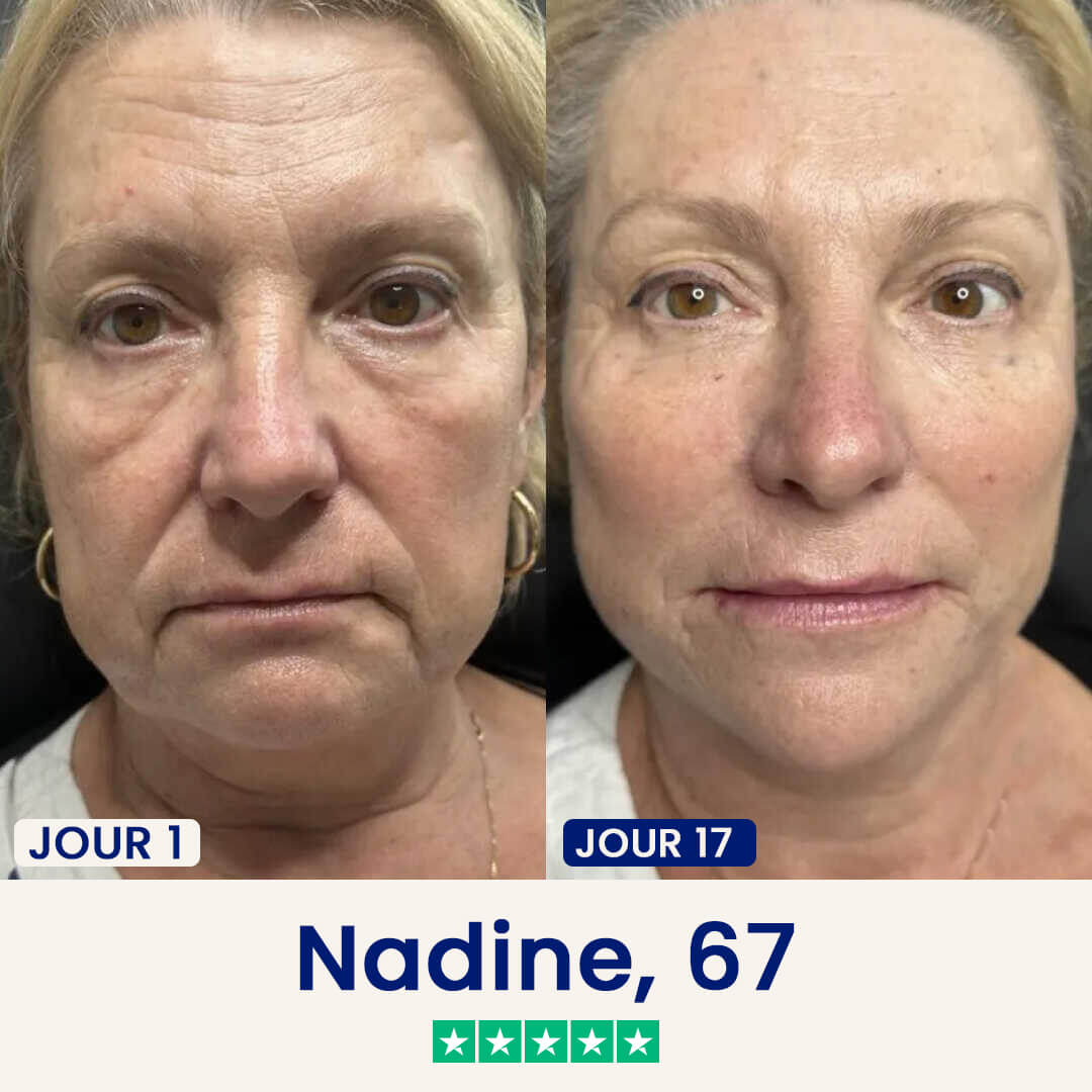 Masque lifting Double Menton