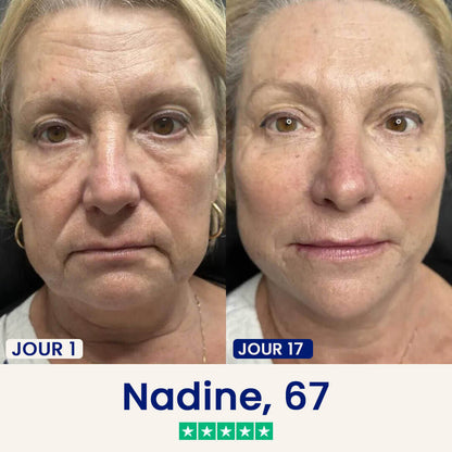 Masque lifting Double Menton