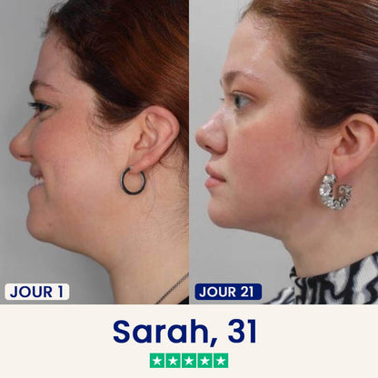 Masque lifting Double Menton